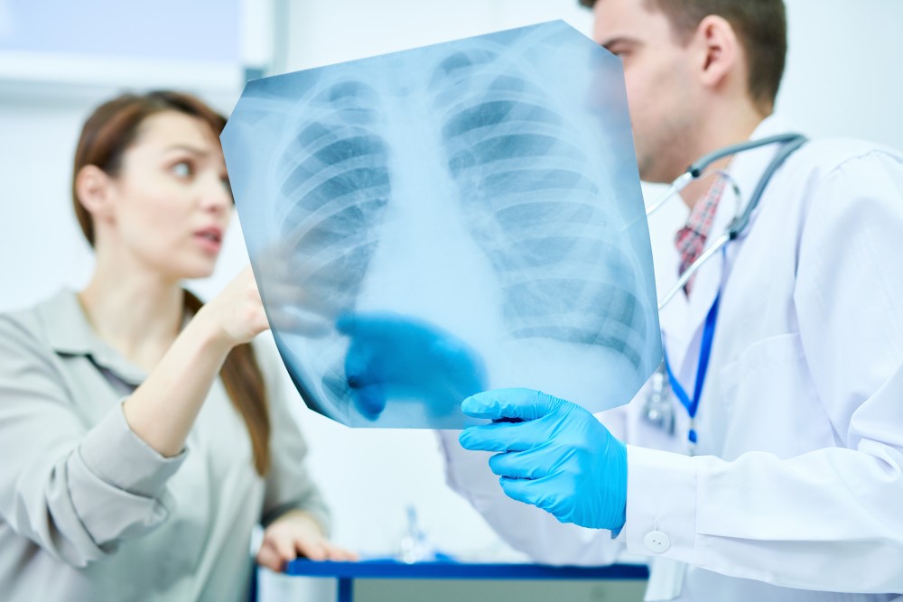O Que e Cirrose Pulmonar e Tratamento
